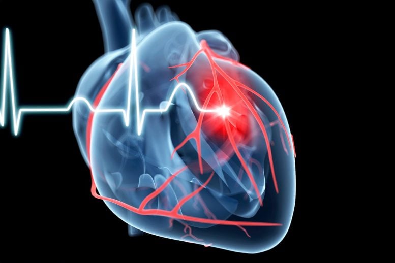 Cardiology Comparison of Heart Attack